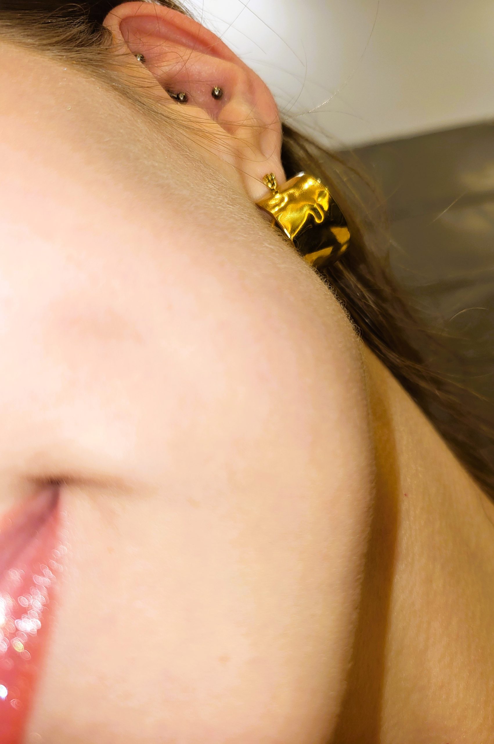 What Are the Best Ways to Remove Peach Fuzz from Your Face