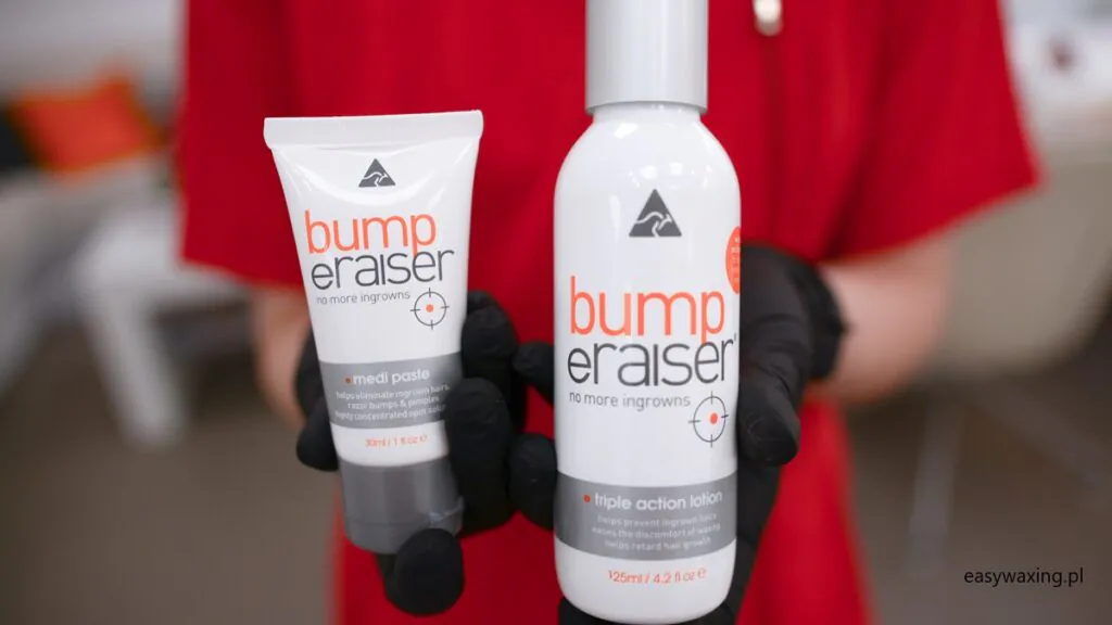 O sposobach na wrastające włoski po depilacji słów kilka